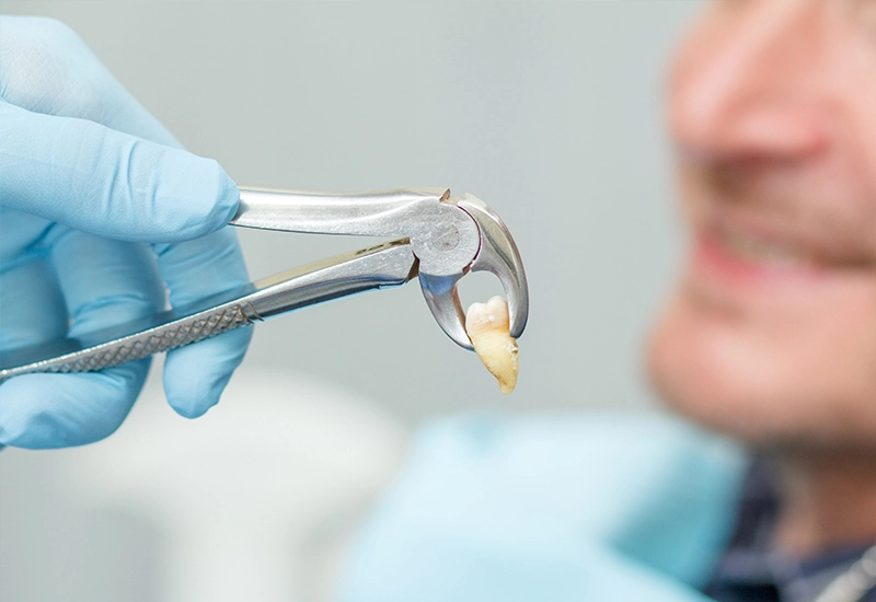 Extractions